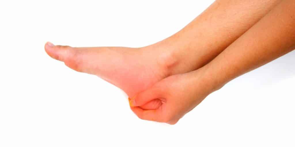 Heel Spurs & Plantar Fasciitis 1